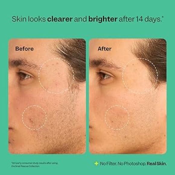 Peach Slices Snail Rescue Blemish Busting Toner - Picture 6 of 7